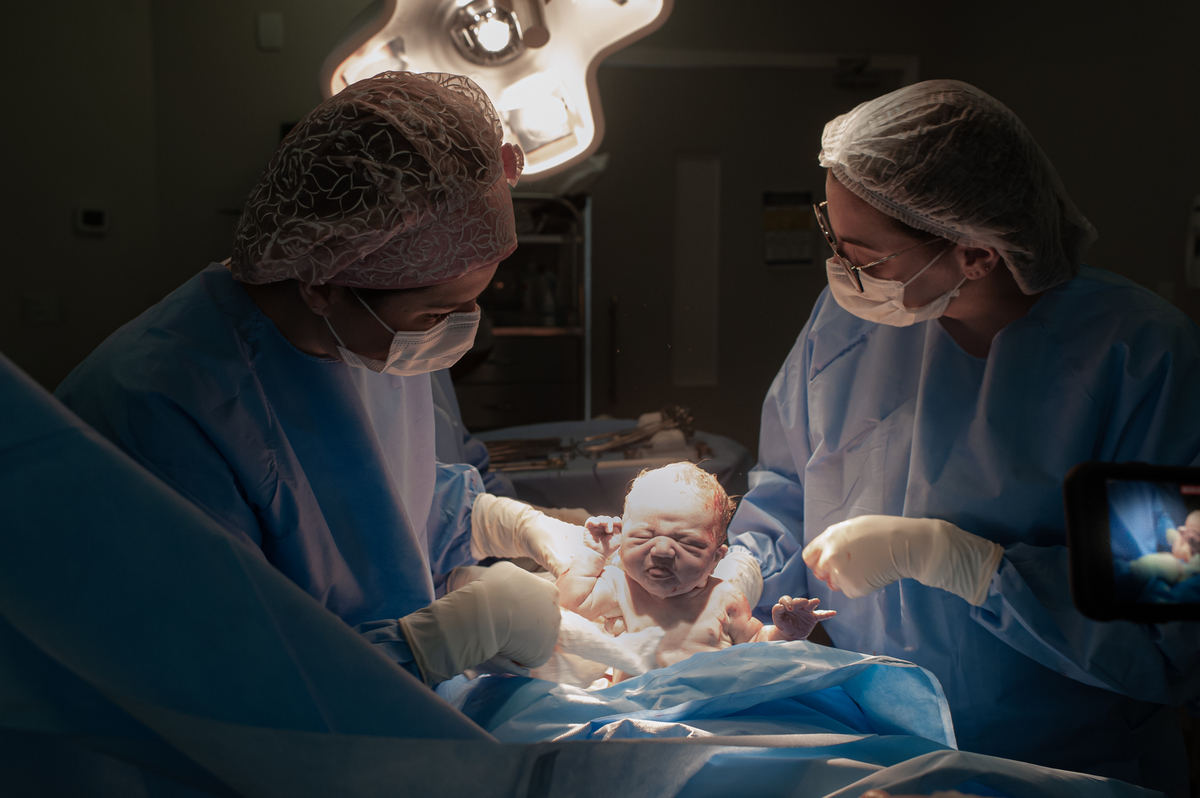 fotografia de parto, foto de parto, registro fotografico de parto, parto cesarea, fotos de cesarea, fotografa de parto, foto de nascimento, foto de parto na perinatal, melhor fotografa de partos