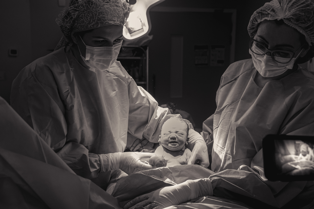fotografia de parto, foto de parto, registro fotografico de parto, parto cesarea, fotos de cesarea, fotografa de parto, foto de nascimento, foto de parto na perinatal, melhor fotografa de partos