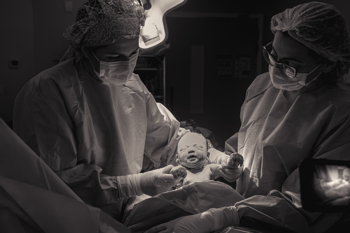 fotografia de parto, foto de parto, registro fotografico de parto, parto cesarea, fotos de cesarea, fotografa de parto, foto de nascimento, foto de parto na perinatal, melhor fotografa de partos