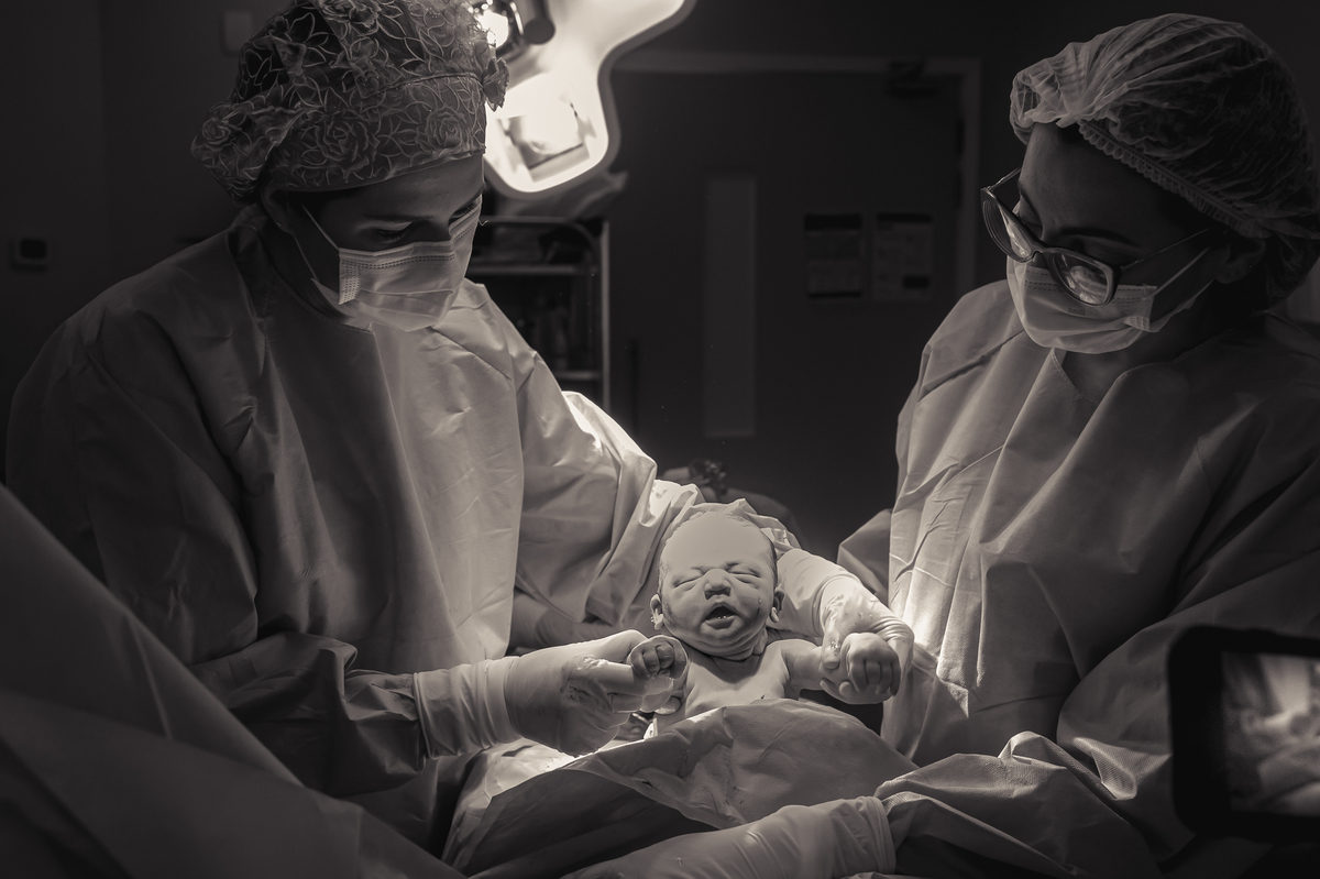 fotografia de parto, foto de parto, registro fotografico de parto, parto cesarea, fotos de cesarea, fotografa de parto, foto de nascimento, foto de parto na perinatal, melhor fotografa de partos