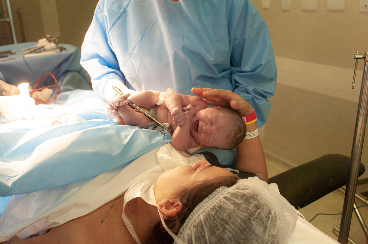 fotografia de parto, foto de parto, registro fotografico de parto, parto cesarea, fotos de cesarea, fotografa de parto, foto de nascimento, foto de parto na perinatal, melhor fotografa de partos