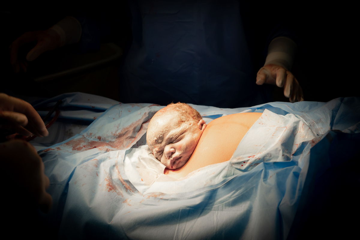 fotografia de parto, foto de parto, parto cesarea, cesarea humanizada, fotos na maternidade, perinatal, perinatal barra, fotógrafa de parto, fotografia newborn, newborn barra da tijuca, newborn rio de janeiro, melhor fotógrafa newborn, fotos de bebê barra