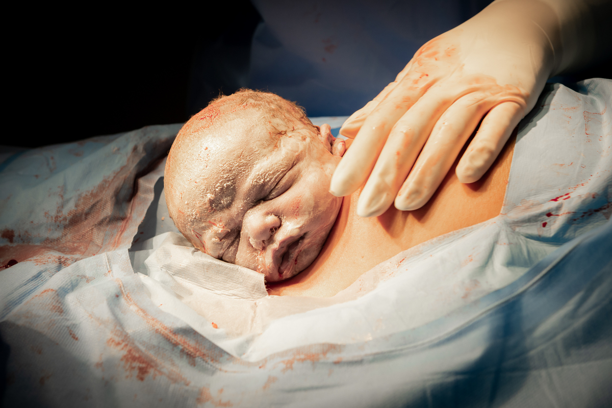 fotografia de parto, foto de parto, parto cesarea, cesarea humanizada, fotos na maternidade, perinatal, perinatal barra, fotógrafa de parto, fotografia newborn, newborn barra da tijuca, newborn rio de janeiro, melhor fotógrafa newborn, fotos de bebê barra