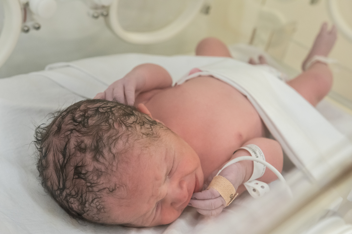 fotografia de parto, fotos de parto, parto cesárea, perinatal, fotos de nascimento, fotógrafa de parto, fotógrafa de bebês, fotografia newborn, fotografia de gestante, cesárea humanizada, melhor fotógrafa newborn
