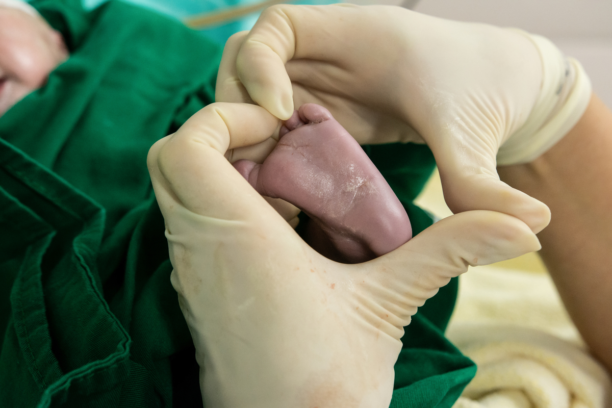 fotos de parto, cobertura de parto, fotografia de parto, filmagem de parto, parto cesáraea, perinatal, perinatal da Barra, newborn, ensaio newborn, melhor fotógrafa de parto, melhor fotógrafa newborn, newborn barra da tijuca, newborn barra