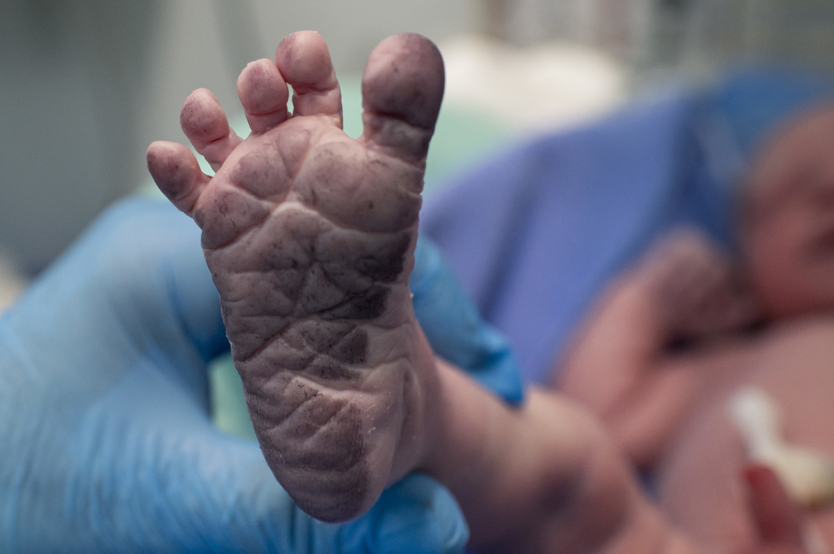 documental de parto, pezinho do bebê