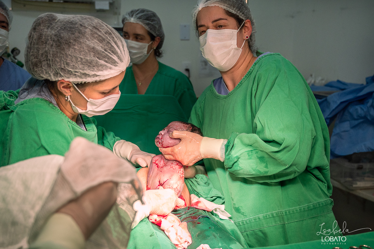 fotografia-de-parto-cesariana-fotos-santa-casa-de-misericordia-de-barbacena-fotos-de-cesaria-fotos-de-parto-fotografa-especializada-em-sala-de-parto-obstetra-em-barbacena-dra-maria-clara-marangoni-fotografa-de-bebes-isabela-lobato-fotografia-barbacena-mg