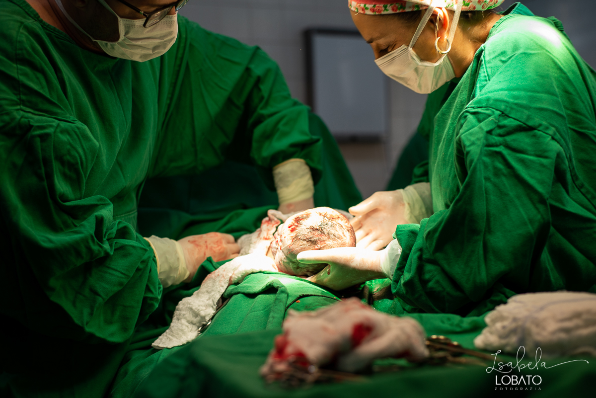 fotografia-de-parto-nascimento-de-bebe-cesariana-foto-de-bebe-nascendo-hospital-santa-casa-de-misericordia-barbacena-minas-gerais-obstetra-dra-roberta-sales-equipe-gestar-barbacena-nascimento-fotografo-em-barbacena-estudio-isabela-lobato-fotografia