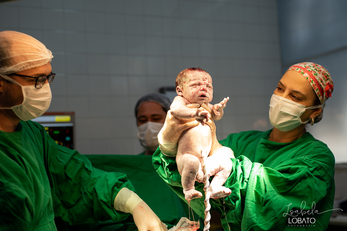 fotografia-de-parto-nascimento-de-bebe-cesariana-foto-de-bebe-nascendo-hospital-santa-casa-de-misericordia-barbacena-minas-gerais-obstetra-dra-roberta-sales-equipe-gestar-barbacena-nascimento-fotografo-em-barbacena-estudio-isabela-lobato-fotografia