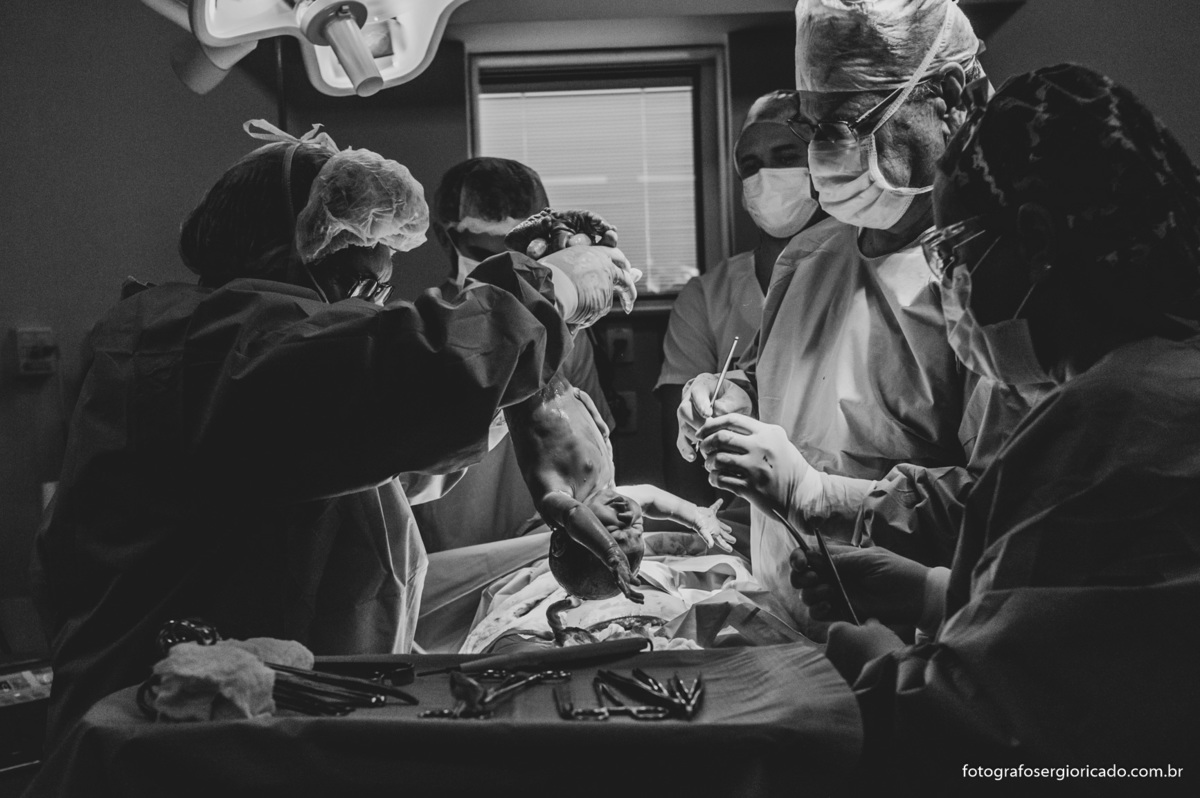 Fotografia de parto na Perinatal da Barra no Rio de Janeiro