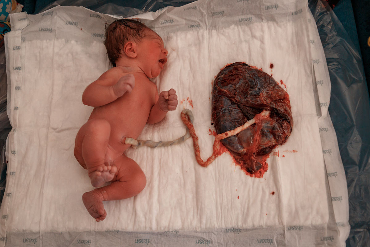 bebê ligado a placenta
