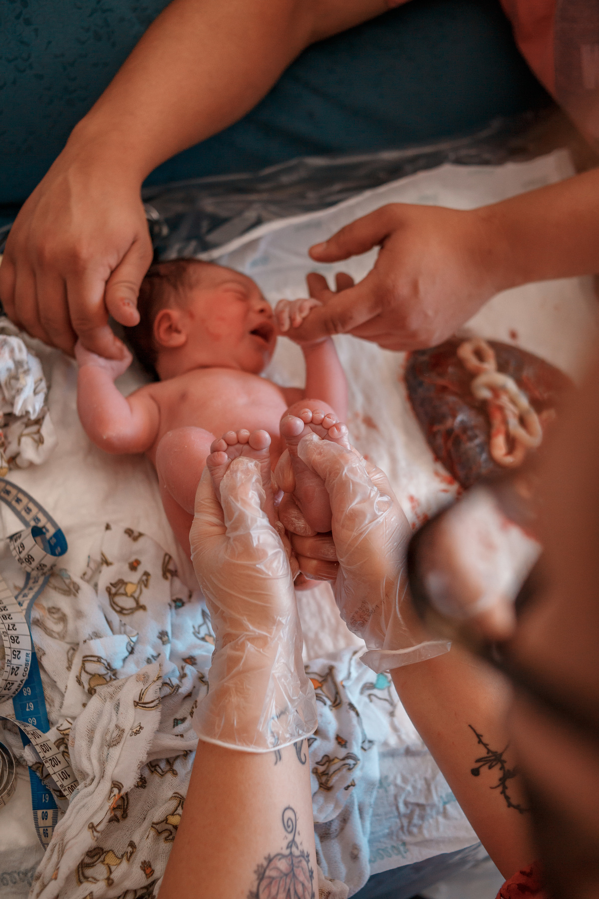 exame físico no recém nascido