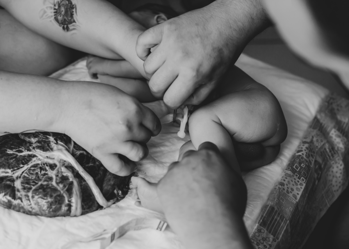 cortando o cordão umbilical do recem nascido