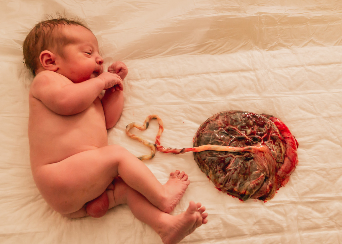 bebê ligado a placenta
