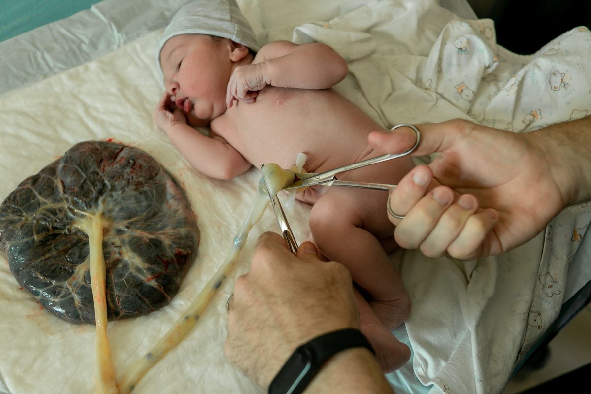 pai cortando o cordão umbilical