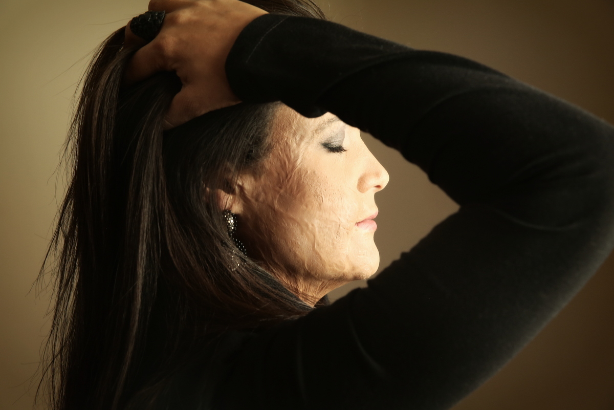 Ivna sá, ivna sá para mulheres, mulher queimada, ensaio feminino em belo horizonte, palestra para mulheres, queimadura, ivna sá fotografia, estúdio em belo horizonte 