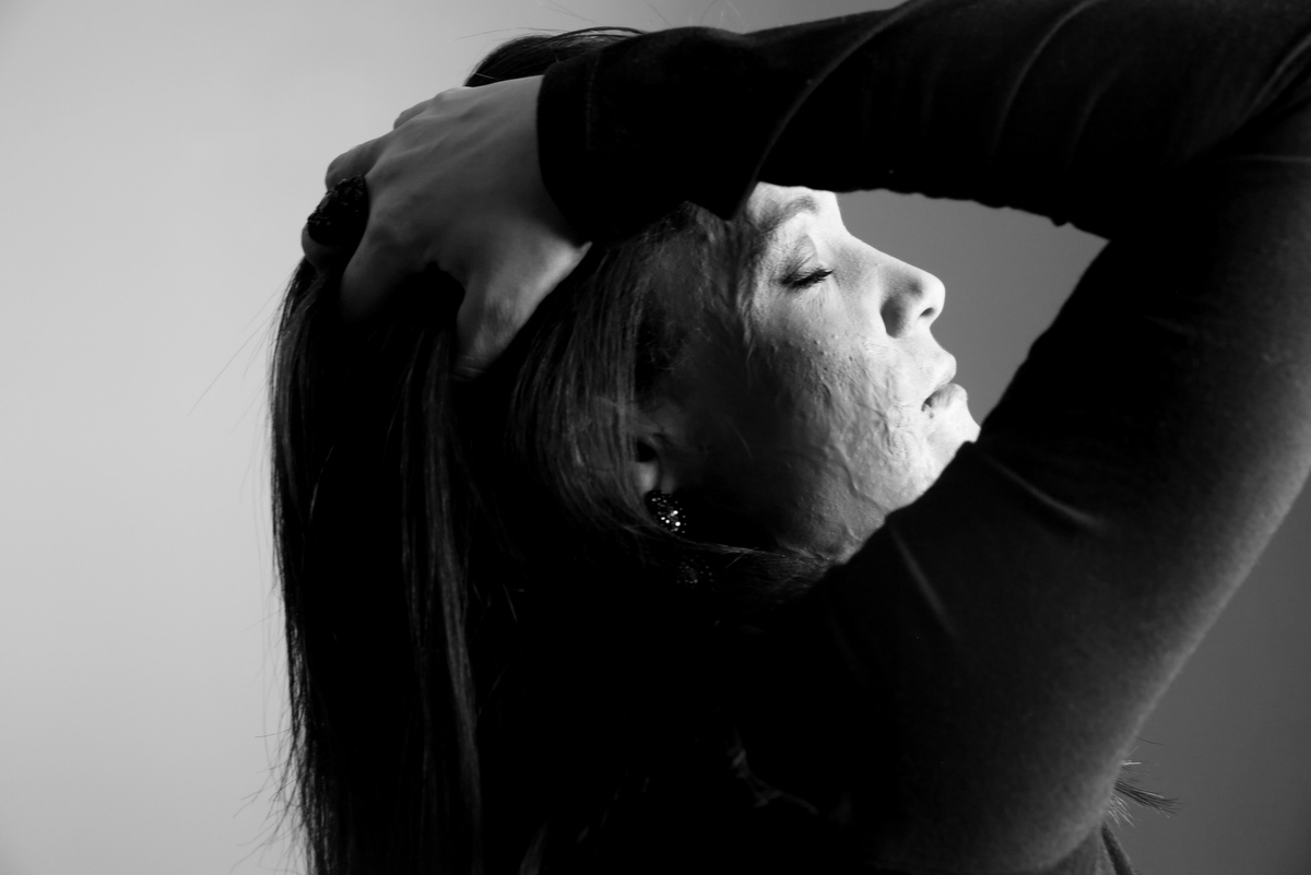 Ivna sá, ivna sá para mulheres, mulher queimada, ensaio feminino em belo horizonte, palestra para mulheres, queimadura, ivna sá fotografia, estúdio em belo horizonte 