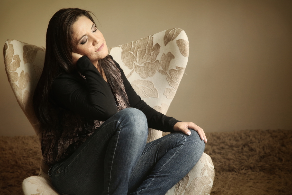 Ivna sá, ivna sá para mulheres, mulher queimada, ensaio feminino em belo horizonte, palestra para mulheres, queimadura, ivna sá fotografia, estúdio em belo horizonte 