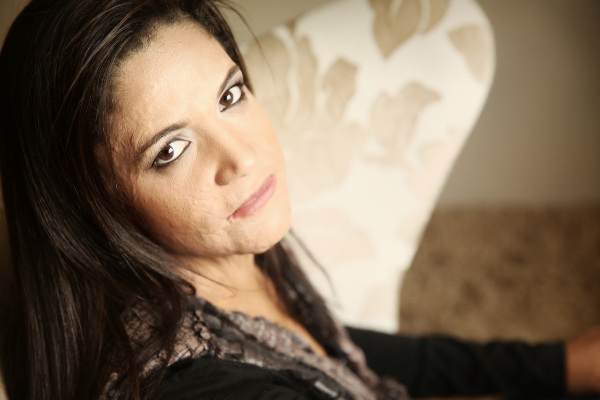 Ivna sá, ivna sá para mulheres, mulher queimada, ensaio feminino em belo horizonte, palestra para mulheres, queimadura, ivna sá fotografia, estúdio em belo horizonte 