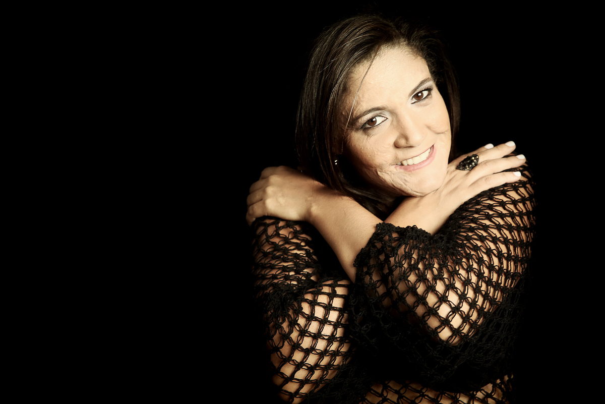 Ivna sá, ivna sá para mulheres, mulher queimada, ensaio feminino em belo horizonte, palestra para mulheres, queimadura, ivna sá fotografia, estúdio em belo horizonte 