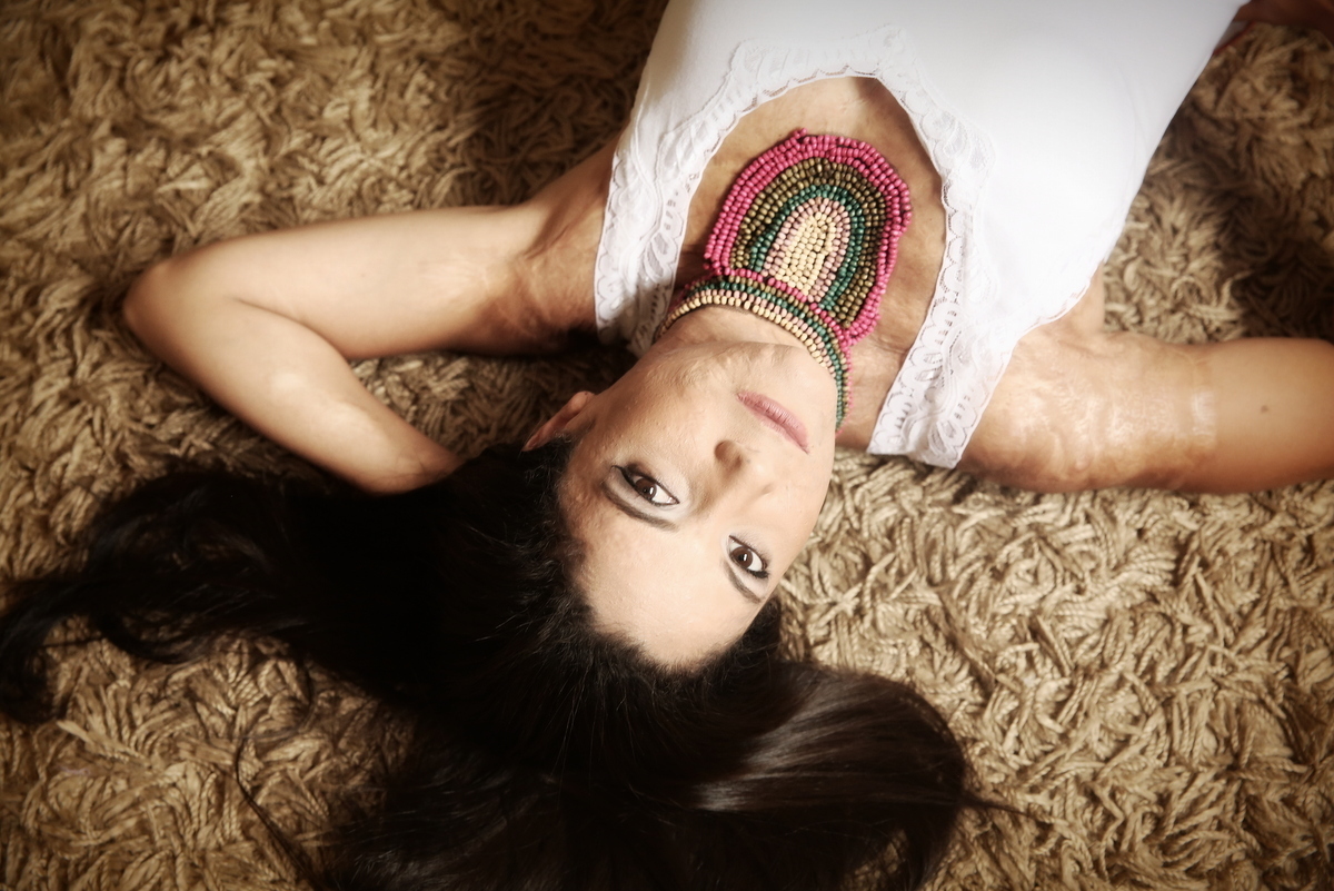 Ivna sá, ivna sá para mulheres, mulher queimada, ensaio feminino em belo horizonte, palestra para mulheres, queimadura, ivna sá fotografia, estúdio em belo horizonte 