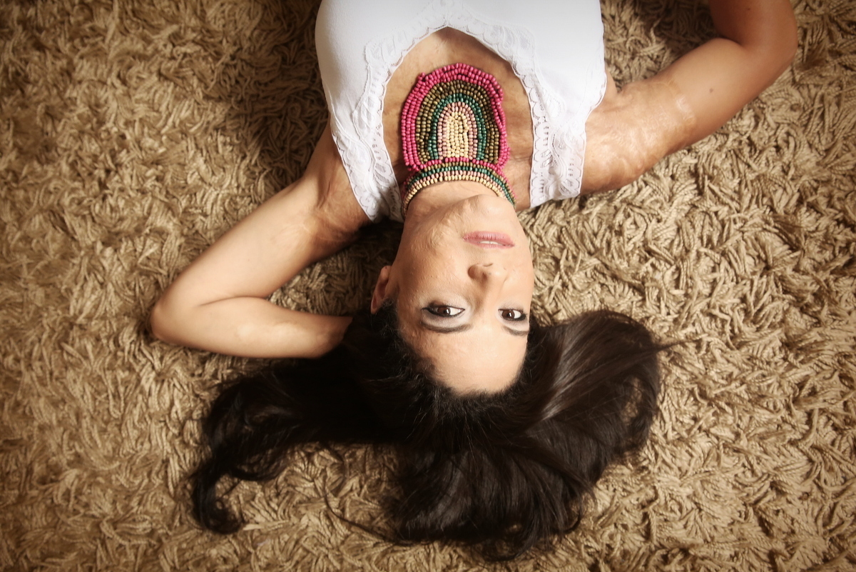 Ivna sá, ivna sá para mulheres, mulher queimada, ensaio feminino em belo horizonte, palestra para mulheres, queimadura, ivna sá fotografia, estúdio em belo horizonte 