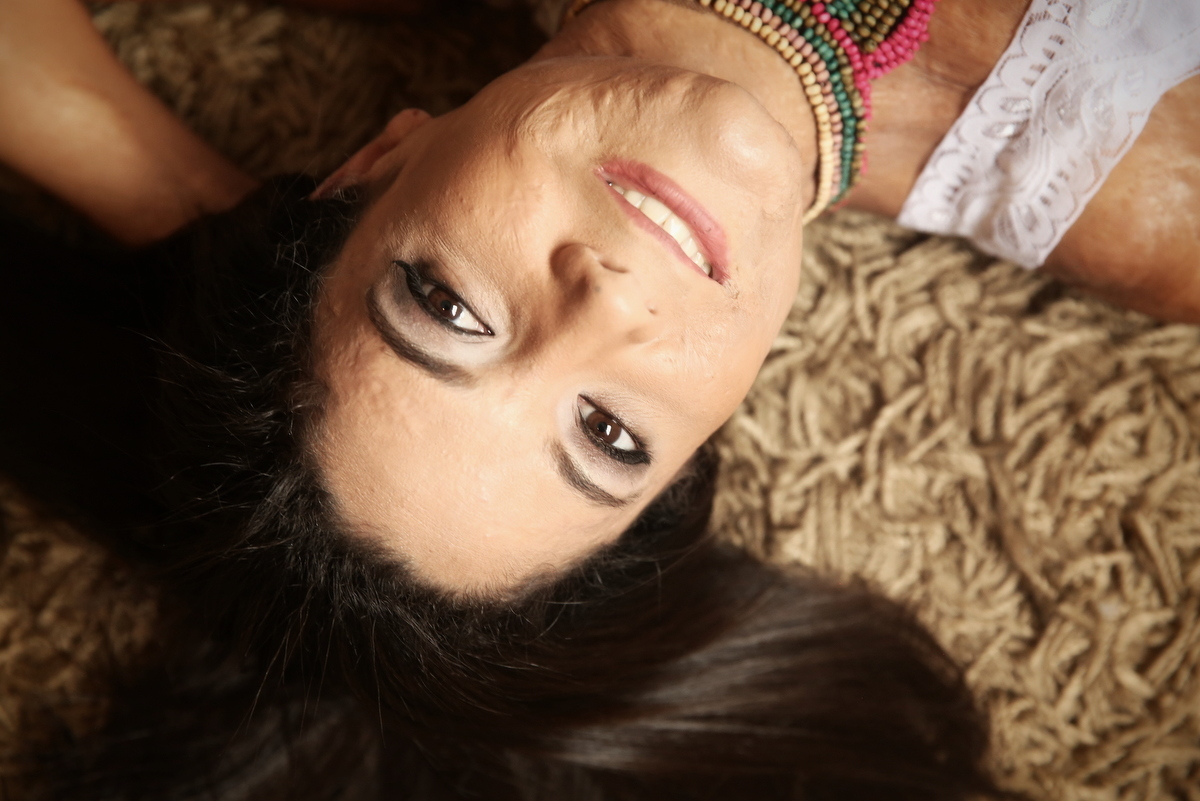 Ivna sá, ivna sá para mulheres, mulher queimada, ensaio feminino em belo horizonte, palestra para mulheres, queimadura, ivna sá fotografia, estúdio em belo horizonte 