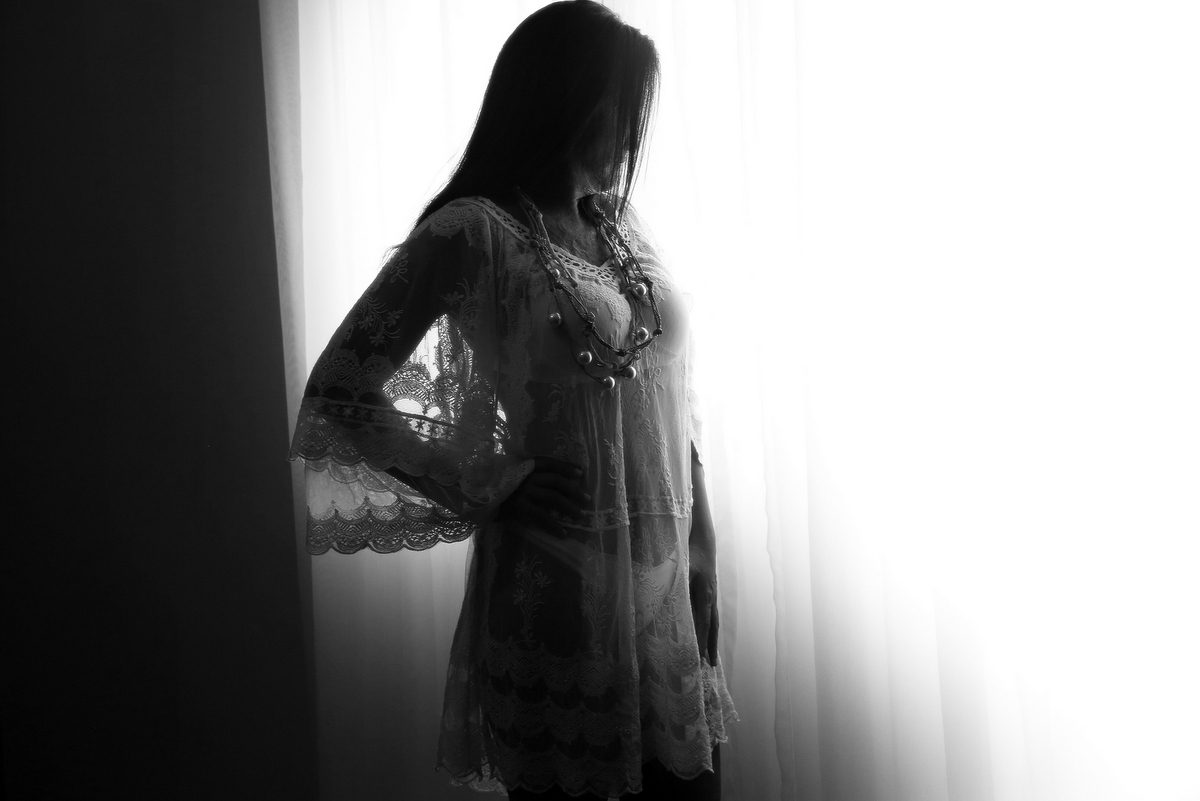 Ivna sá, ivna sá para mulheres, mulher queimada, ensaio feminino em belo horizonte, palestra para mulheres, queimadura, ivna sá fotografia, estúdio em belo horizonte 