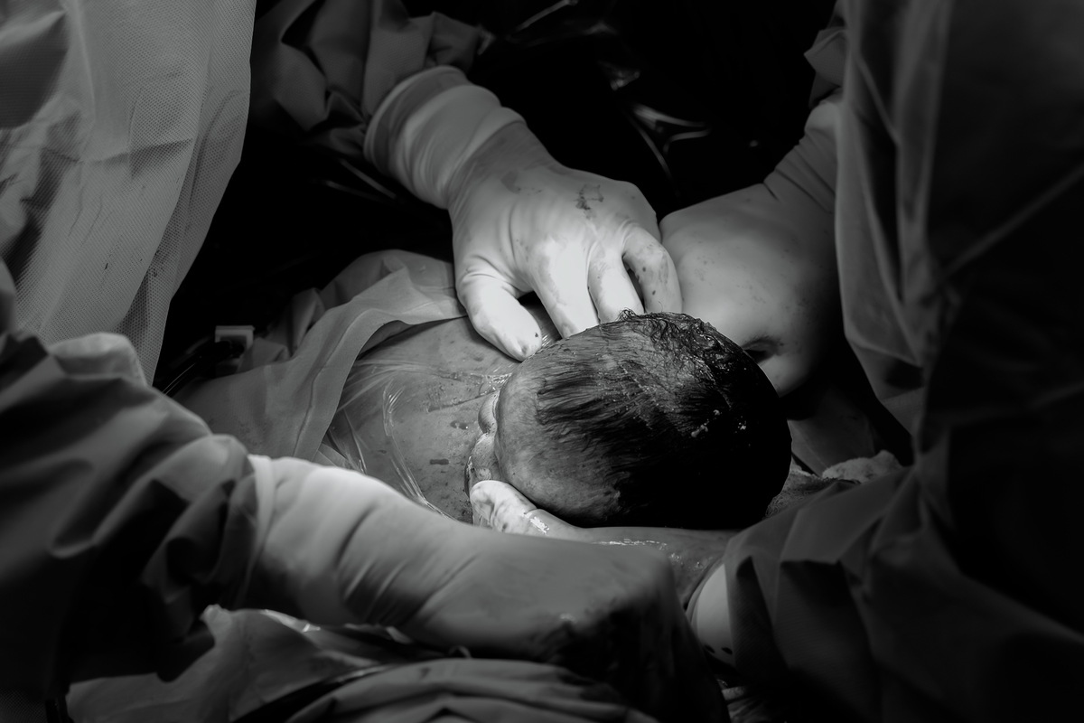 Fotografia de parto; Maternidade Santa Joana; foto de parto; Foto de família; Adri Silva Fotografia; fotografa na zona sul de são paulo; maternidade Pro Matre