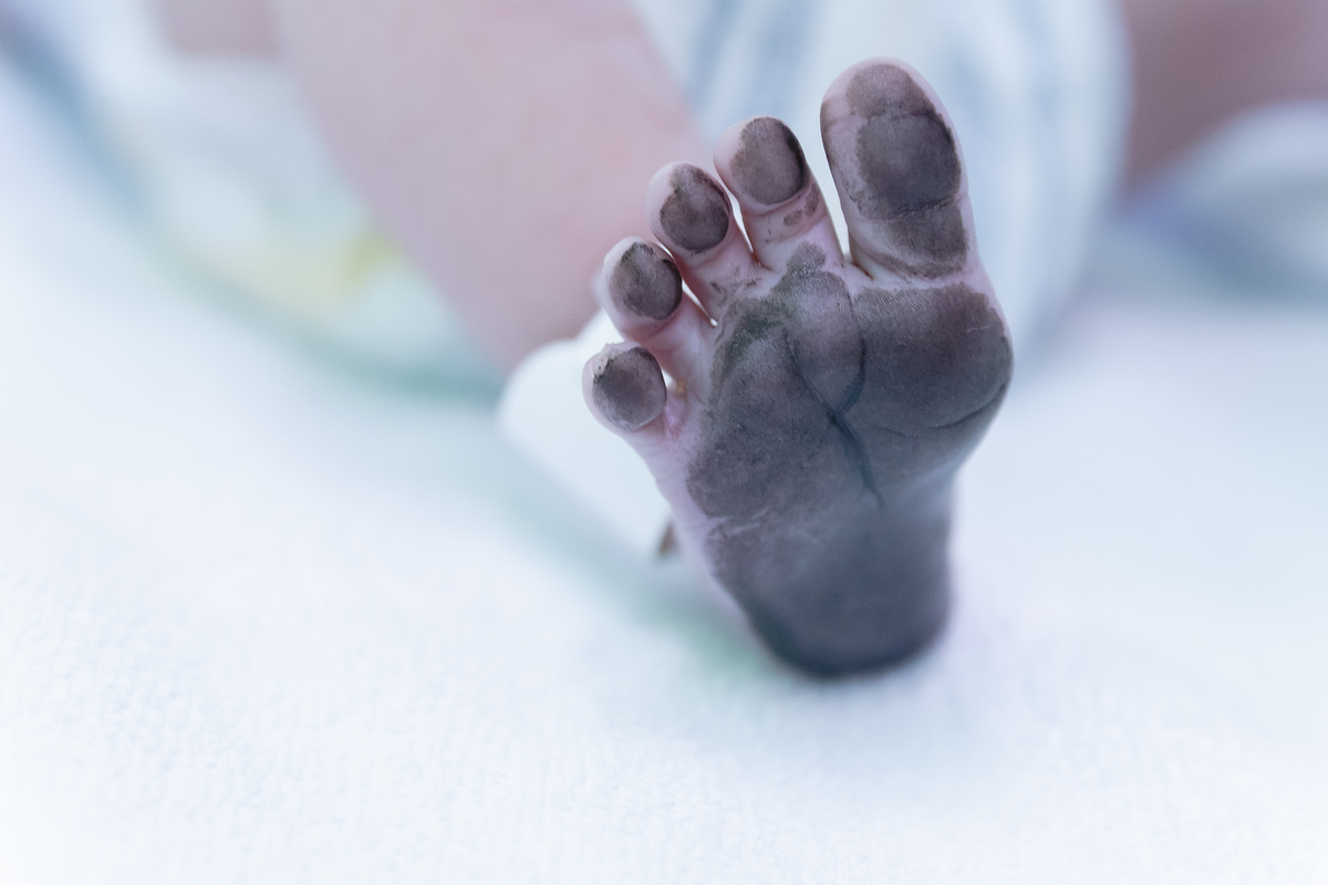 Foto de parto; Adri Silva Fotografia; maternidade Pro Matre; Foto de família; recem nascido