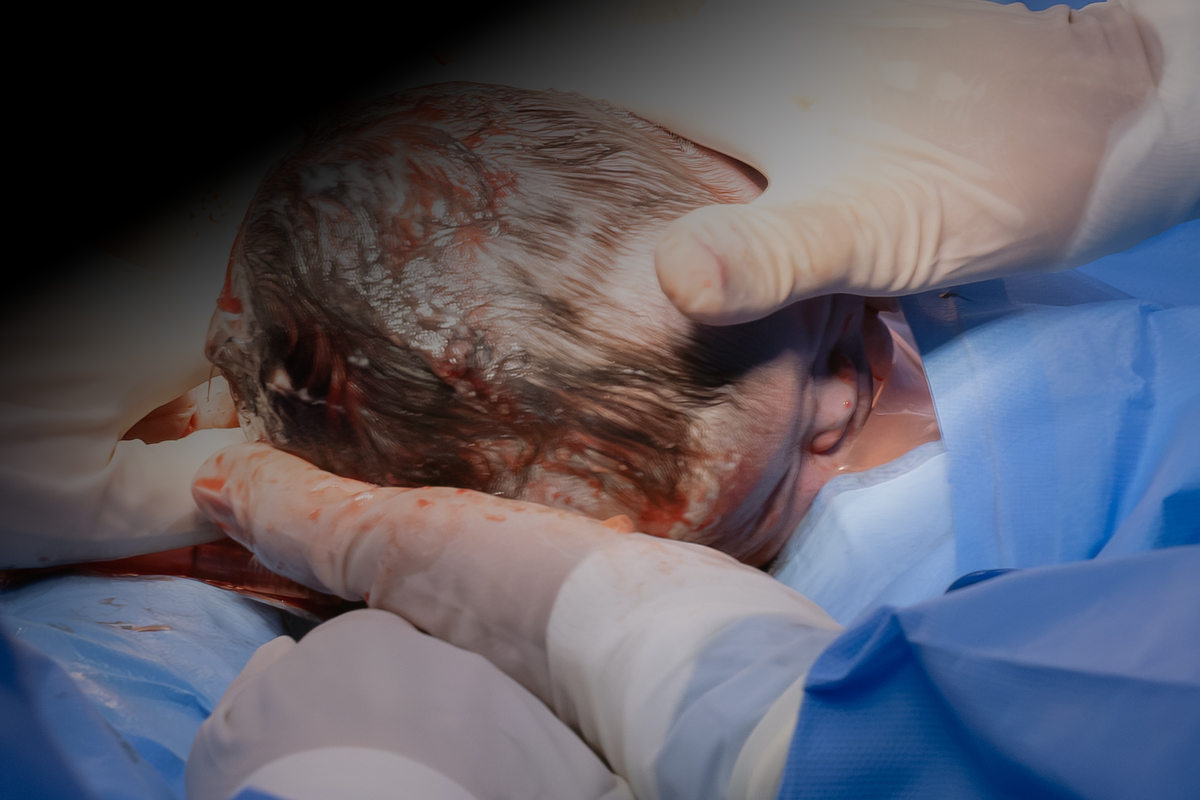 Foto de parto; foto de recem nascido; adri silva fotografia; maternidade Pro Matre; fotografa na zona sul de são paulo