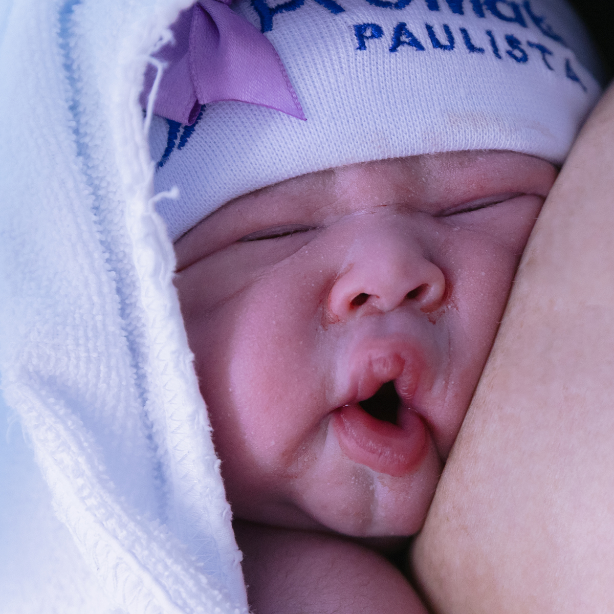 Foto de parto; foto de recem nascido; adri silva fotografia; maternidade Pro Matre; fotografa na zona sul de são paulo