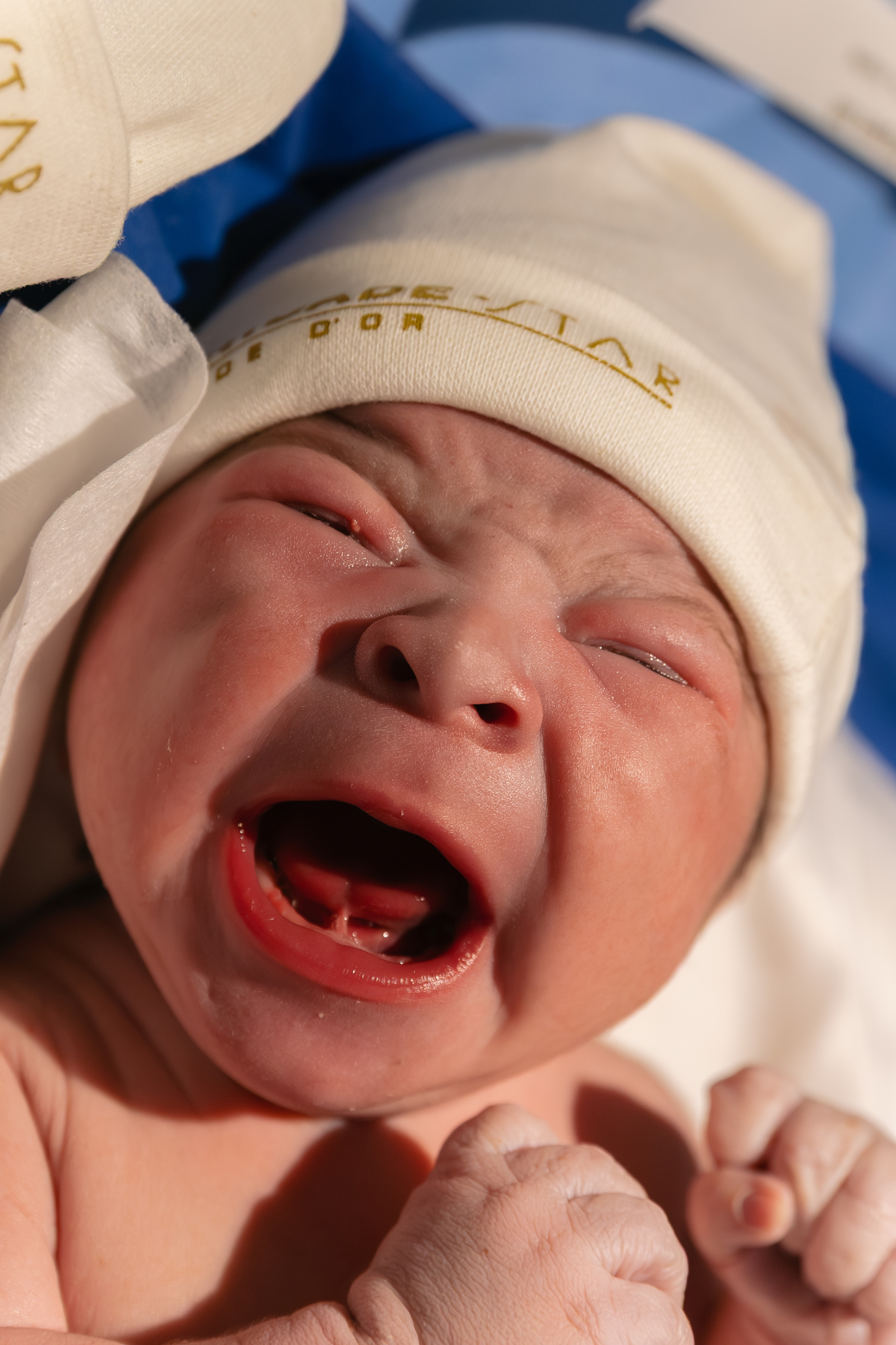 Fotografia de parto; maternidade são Luiz Star; foto de recem nascido; fotografa na zona sul de São Paulo