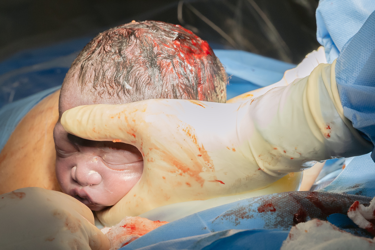 Fotografia de parto; Adri Silva Fotografia; fotografa na zona sul de são paulo; maternidade; maternidade Santa Maria; foto de família