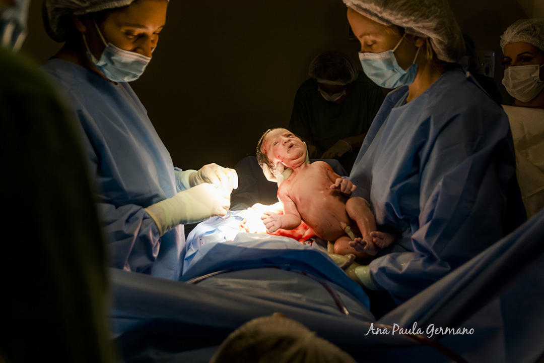 Hospital da Luz Vila Mariana | Fotografo de Parto Credenciado | 5