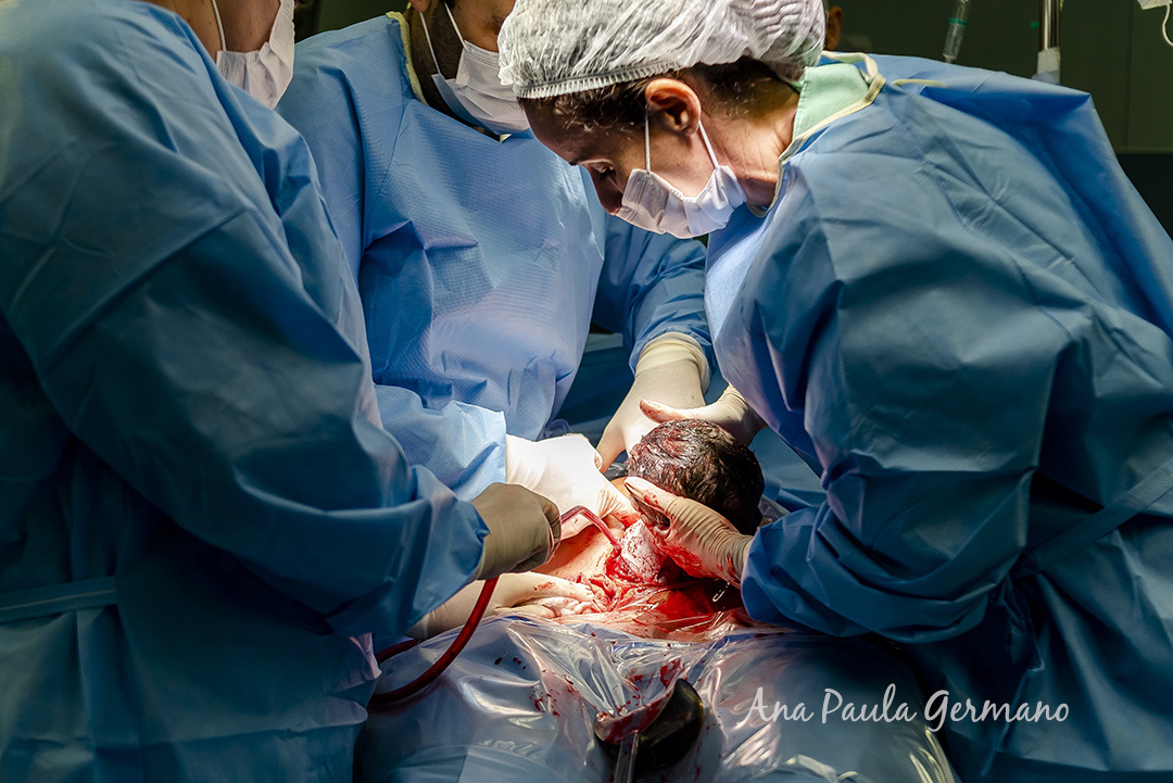 Fotografia de Parto - Hospital Samaritano/SP | 14