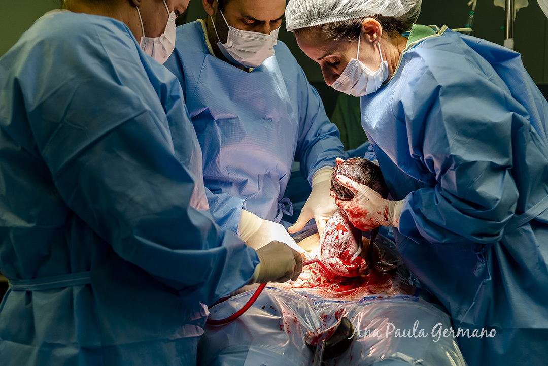 Fotografia de Parto - Hospital Samaritano/SP | 15