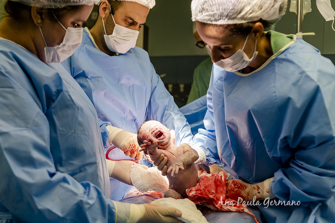 Fotografia de Parto - Hospital Samaritano/SP | 16