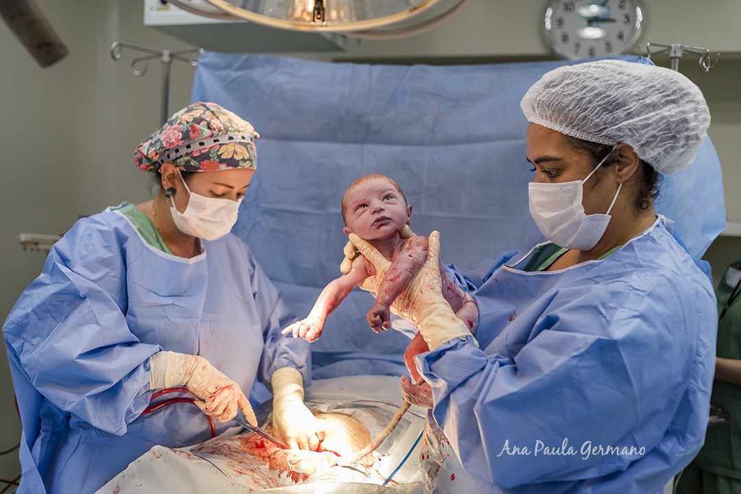 Fotografia de Parto - Hospital Cruz Azul | 14