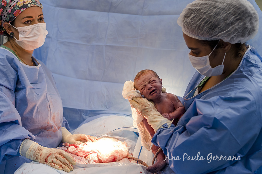 Fotografia de Parto - Hospital Cruz Azul | 16