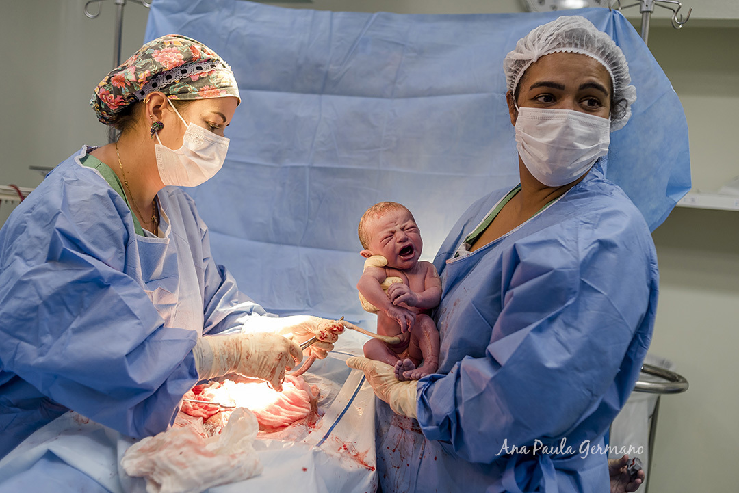 Fotografia de Parto - Hospital Cruz Azul | 17