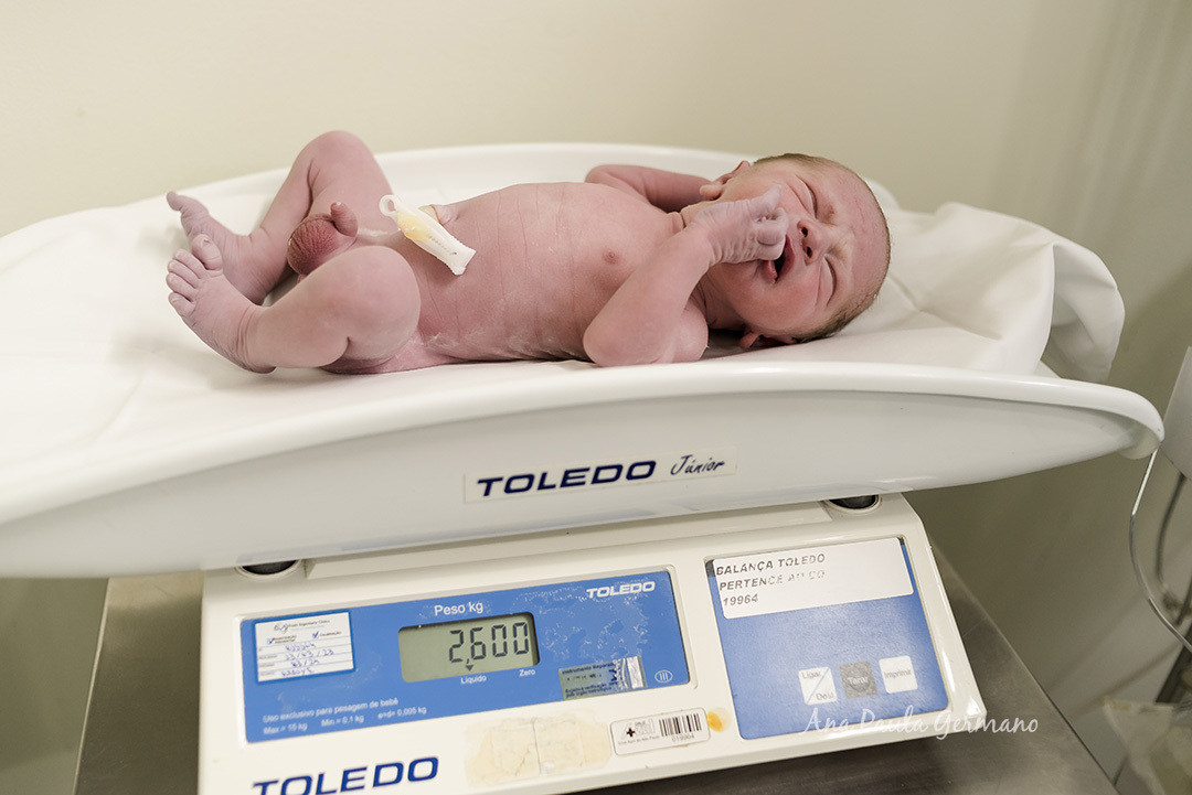 Fotografia de Parto - Hospital Cruz Azul | 20