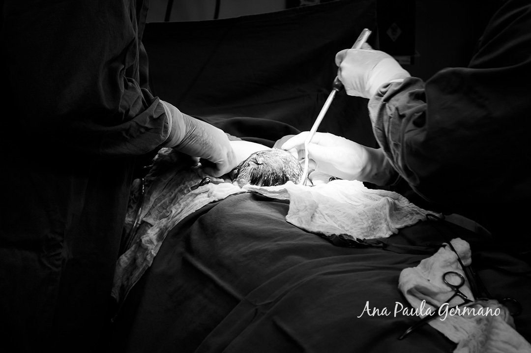 Fotografia de Parto - Hospital Nipo-Brasileiro/SP 1 | Antonella 14