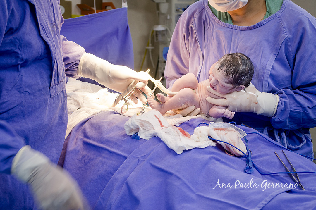 Fotografia de Parto - Hospital Nipo-Brasileiro/SP 1 | Antonella 18