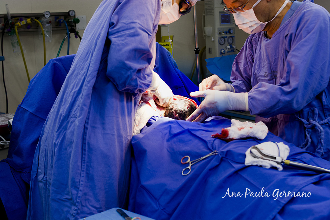 Fotografia de Parto - Hospital Nipo Brasileiro/SP | Nascimento bebê Heitor 13