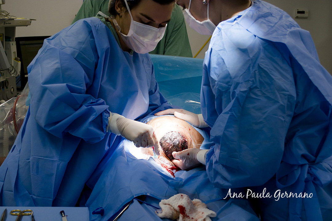 Fotografia de Parto - Maternidade Santa Maria - Nascimento do Davi | 12