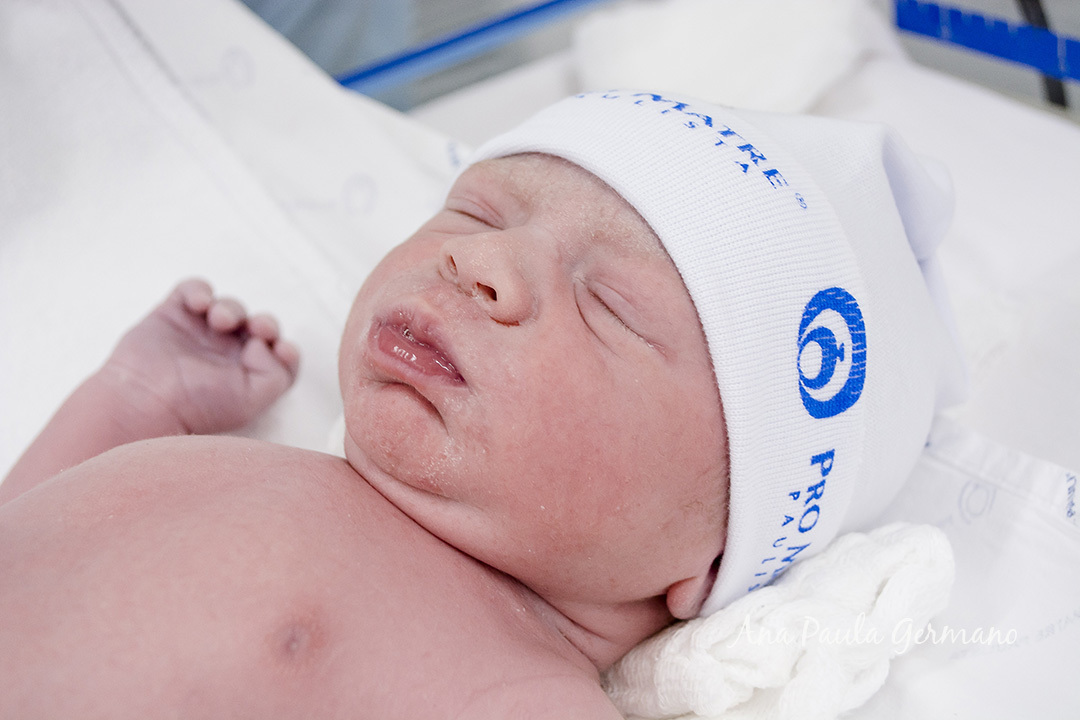 Fotografia de Parto - Maternidade Pro Matre Paulista - Nascimento do Bernardo | 23