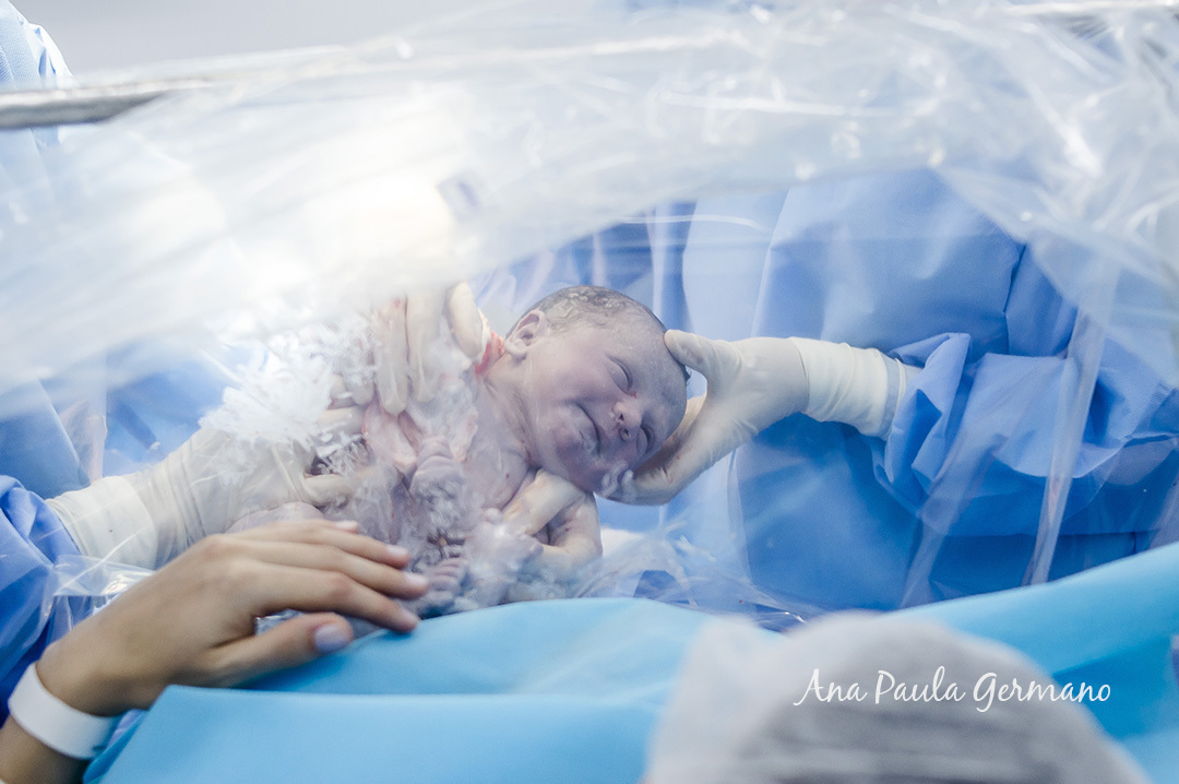 Fotografia de Parto - Maternidade Pro Matre Paulista - Nascimento do Bernardo | 18