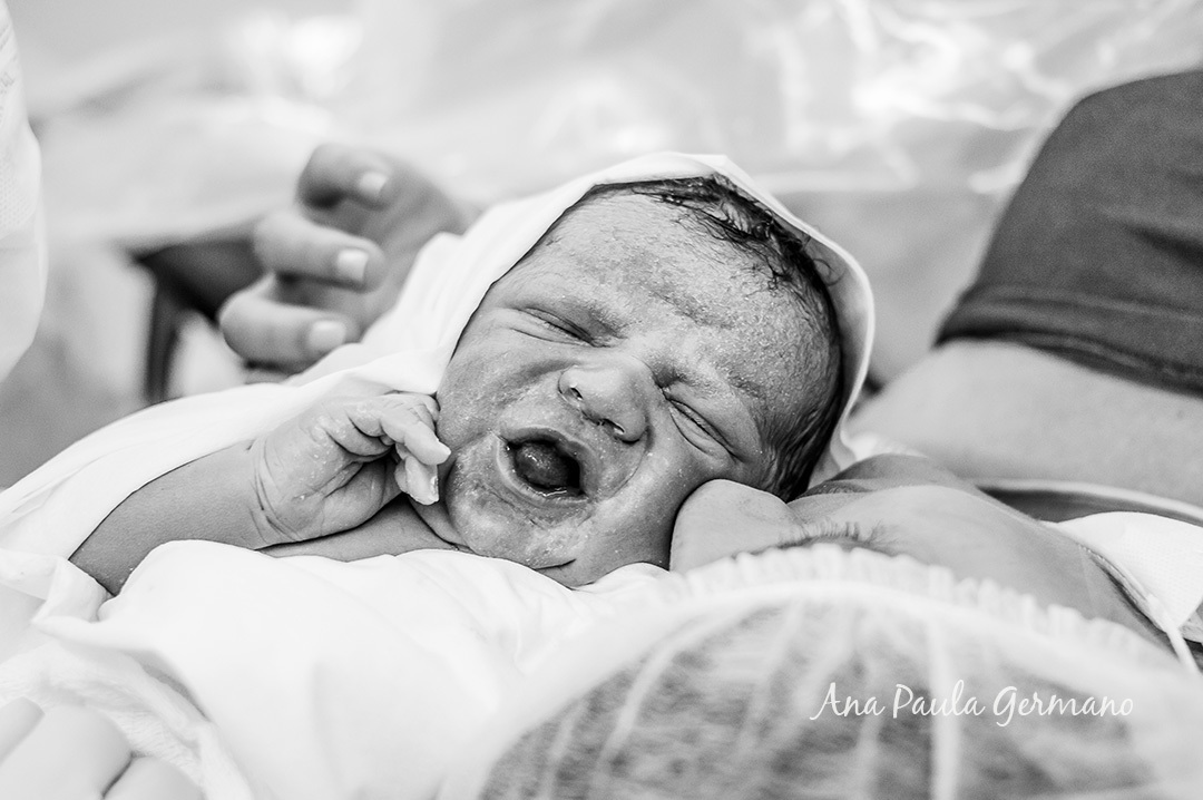 Fotografia de Parto - Maternidade Pro Matre Paulista - Nascimento do Bernardo | 19