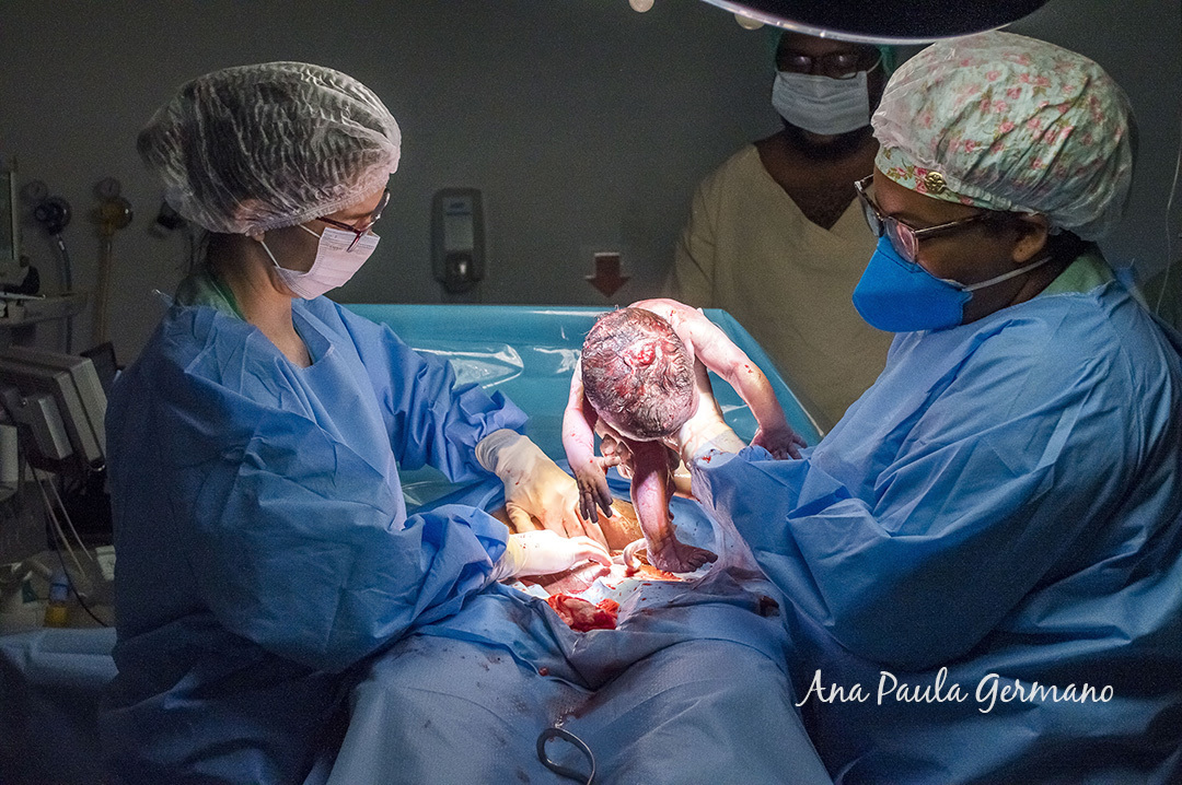Registro de Parto - Fotografia e Filmagem - Maternidade Santa Joana 3